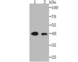 Invitrogen AMACR Monoclonal Antibody (6F5) 100 &mu;L; Unconjugated:Antibodies,