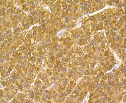 Invitrogen GPX1 Monoclonal Antibody (A6-C0-B9) 100 &mu;L | Buy Online | Invitrogen&trade; | Fisher Scientific