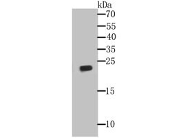 Invitrogen GPX1 Monoclonal Antibody (A6-C0-B9) 100 &mu;L | Buy Online | Invitrogen&trade; | Fisher Scientific
