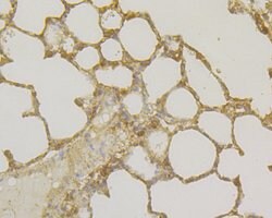 Thermo Scientific TNFRSF11B Monoclonal Antibody (9C1):Antibodies, Monoclonal
