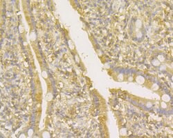 Thermo Scientific TNFRSF11B Monoclonal Antibody (9C1):Antibodies, Monoclonal