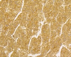 Thermo Scientific TNFRSF11B Monoclonal Antibody (9C1):Antibodies, Monoclonal