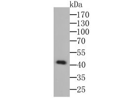 Thermo Scientific TNFRSF11B Monoclonal Antibody (9C1):Antibodies, Monoclonal