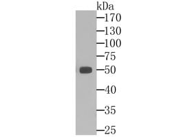 Invitrogen ALDH1A1 Monoclonal Antibody (8F1) 100 &mu;L; Unconjugated:Antibodies,