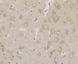Invitrogen Carbonic Anhydrase II Monoclonal Antibody (11A1) 100 &mu;L;