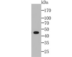 Invitrogen HLA-ABC Monoclonal Antibody (11C3) 100 &mu;L; Unconjugated:Antibodies,