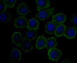 Invitrogen Carbonic Anhydrase II Monoclonal Antibody (11A2) 100 &mu;L;
