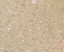 Invitrogen Carbonic Anhydrase II Monoclonal Antibody (11A2) 100 &mu;L;