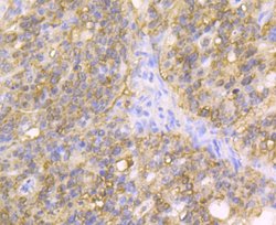 Invitrogen Carbonic Anhydrase II Monoclonal Antibody (11A2) 100 &mu;L;