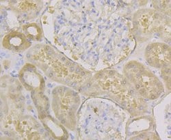 Invitrogen Carbonic Anhydrase II Monoclonal Antibody (11A2) 100 &mu;L;