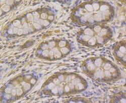 Invitrogen Carbonic Anhydrase II Monoclonal Antibody (11A2) 100 &mu;L;