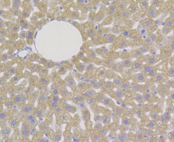 Invitrogen DAPK1 Monoclonal Antibody (12B2) 100 &mu;L; Unconjugated:Antibodies,