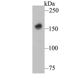 Invitrogen DAPK1 Monoclonal Antibody (12B2) 100 &mu;L; Unconjugated:Antibodies,