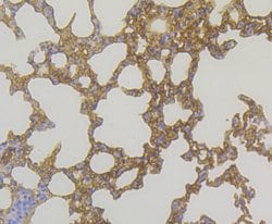 Invitrogen GSTP1 Monoclonal Antibody (11D5) 100 &mu;L; Unconjugated:Antibodies,