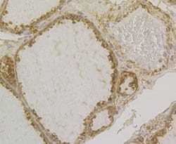 Invitrogen GSTP1 Monoclonal Antibody (11D5) 100 &mu;L; Unconjugated:Antibodies,