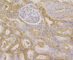 Invitrogen GSTP1 Monoclonal Antibody (11D5) 100 &mu;L; Unconjugated:Antibodies,