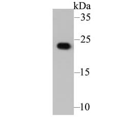 Invitrogen GSTP1 Monoclonal Antibody (11D5) 100 &mu;L; Unconjugated:Antibodies,