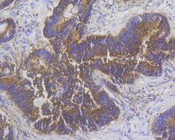Invitrogen Stathmin 1 Monoclonal Antibody (11E1) 100 &mu;L; Unconjugated:Antibodies,