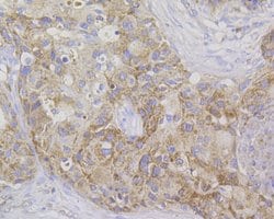 Invitrogen Stathmin 1 Monoclonal Antibody (11E1) 100 &mu;L; Unconjugated:Antibodies,