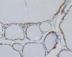 Thermo Scientific NME1 Monoclonal Antibody (12A1):Antibodies, Monoclonal