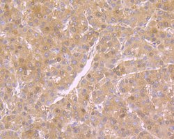 Thermo Scientific NME1 Monoclonal Antibody (12A1):Antibodies, Monoclonal