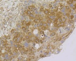 Thermo Scientific NME1 Monoclonal Antibody (12A1):Antibodies, Monoclonal