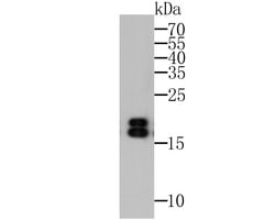 Thermo Scientific NME1 Monoclonal Antibody (12A1):Antibodies, Monoclonal