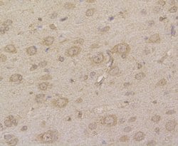 Invitrogen HIP1 Monoclonal Antibody (13E1) 100 μL; Unconjugated:Antibodies,