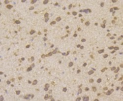 Invitrogen HIP1 Monoclonal Antibody (13E1) 100 μL; Unconjugated:Antibodies,