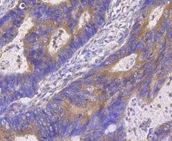 Invitrogen HIP1 Monoclonal Antibody (13E1) 100 μL; Unconjugated:Antibodies,