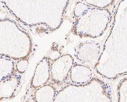 Invitrogen NME1 Monoclonal Antibody (13C1) 100 &mu;L | Buy Online | Invitrogen&trade; | Fisher Scientific