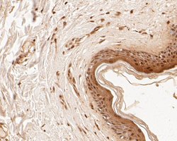 Invitrogen NME1 Monoclonal Antibody (13C1) 100 &mu;L | Buy Online | Invitrogen&trade; | Fisher Scientific