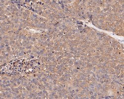 Invitrogen SERPINC1 Monoclonal Antibody (15F2) 100 &mu;L; Unconjugated:Antibodies,