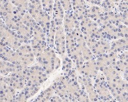 Invitrogen SERPINC1 Monoclonal Antibody (15F2) 100 &mu;L; Unconjugated:Antibodies,