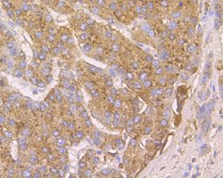 Thermo Scientific Cathepsin D Monoclonal Antibody (13F3):Antibodies, Monoclonal