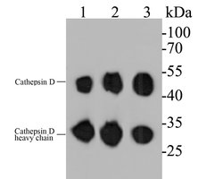 Thermo Scientific Cathepsin D Monoclonal Antibody (13F3):Antibodies, Monoclonal