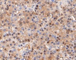 Thermo Scientific Thymidine Phosphorylase Monoclonal Antibody (A1A8):Antibodies,