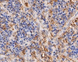 Thermo Scientific Thymidine Phosphorylase Monoclonal Antibody (A1A8):Antibodies,
