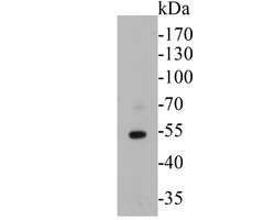 Thermo Scientific Thymidine Phosphorylase Monoclonal Antibody (A1A8):Antibodies,