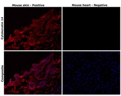 Invitrogen Cytokeratin 14 Monoclonal Antibody (A2C11) 100 &mu;L; Unconjugated:Antibodies,