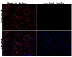 Invitrogen Cytokeratin 14 Monoclonal Antibody (A2C11) 100 &mu;L; Unconjugated:Antibodies,