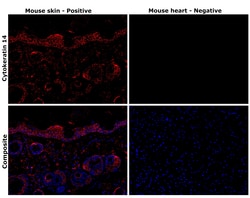 Invitrogen Cytokeratin 14 Monoclonal Antibody (A2C11) 100 &mu;L; Unconjugated:Antibodies,