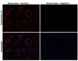 Invitrogen Cytokeratin 14 Monoclonal Antibody (A2C11) 100 &mu;L; Unconjugated:Antibodies,