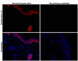 Invitrogen Cytokeratin 14 Monoclonal Antibody (A2C11) 100 &mu;L; Unconjugated:Antibodies,