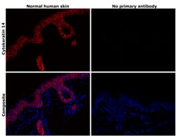Invitrogen Cytokeratin 14 Monoclonal Antibody (A2C11) 100 &mu;L; Unconjugated:Antibodies,