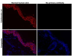 Invitrogen Cytokeratin 14 Monoclonal Antibody (A2C11) 100 &mu;L; Unconjugated:Antibodies,