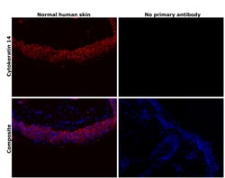 Invitrogen Cytokeratin 14 Monoclonal Antibody (A2C11) 100 &mu;L; Unconjugated:Antibodies,