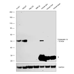 Invitrogen Cytokeratin 14 Monoclonal Antibody (A2C11) 100 &mu;L; Unconjugated:Antibodies,