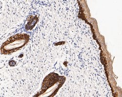 Invitrogen Cytokeratin 14 Monoclonal Antibody (A2C11) 100 &mu;L; Unconjugated:Antibodies,