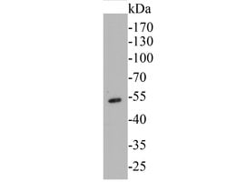 Invitrogen Cytokeratin 14 Monoclonal Antibody (A2C11) 100 &mu;L; Unconjugated:Antibodies,